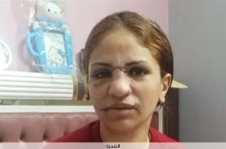 حادث مأساوي اعتداء زوج علي زوجته ويشوه وجهها بالوراق|فيديو
