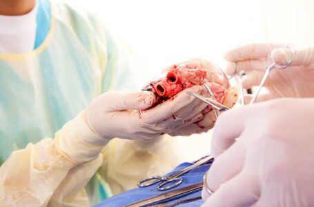 وفاة مريض زرعوا في جسمه قلب خنزير العملية الأولى من نوعها